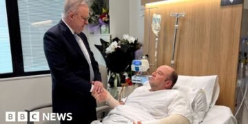 Australia's PM Albanese Visits Bondi Hero Ahmed al Ahmed in Hospital