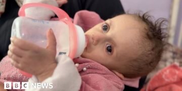 Baby Siwar Re-admitted to Hospital in Gaza After Treatment in Jordan