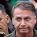 Brazil's Former President Bolsonaro Undergoes Successful Hernia Surgery