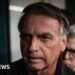 Former Brazilian President Bolsonaro Receives Treatment for Persistent Hiccups