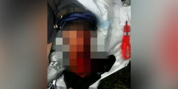 Hawaii Fisherman Survives Shark Attack, Administers Self-Care to Recover