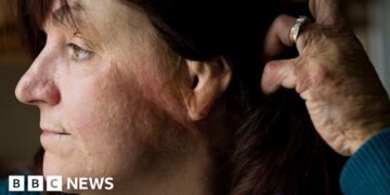 Survivors Reflect on 2003 US 'Flashover' Blaze Amidst Recent Parallels