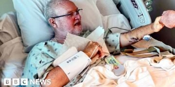 Experiencing a Shark Attack: Survivors Share Their Harrowing Encounters